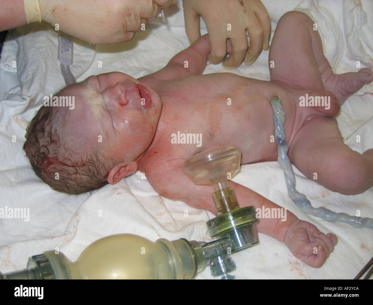 B b gar on naissance apr s avoir v rifier le suivi Photo Stock