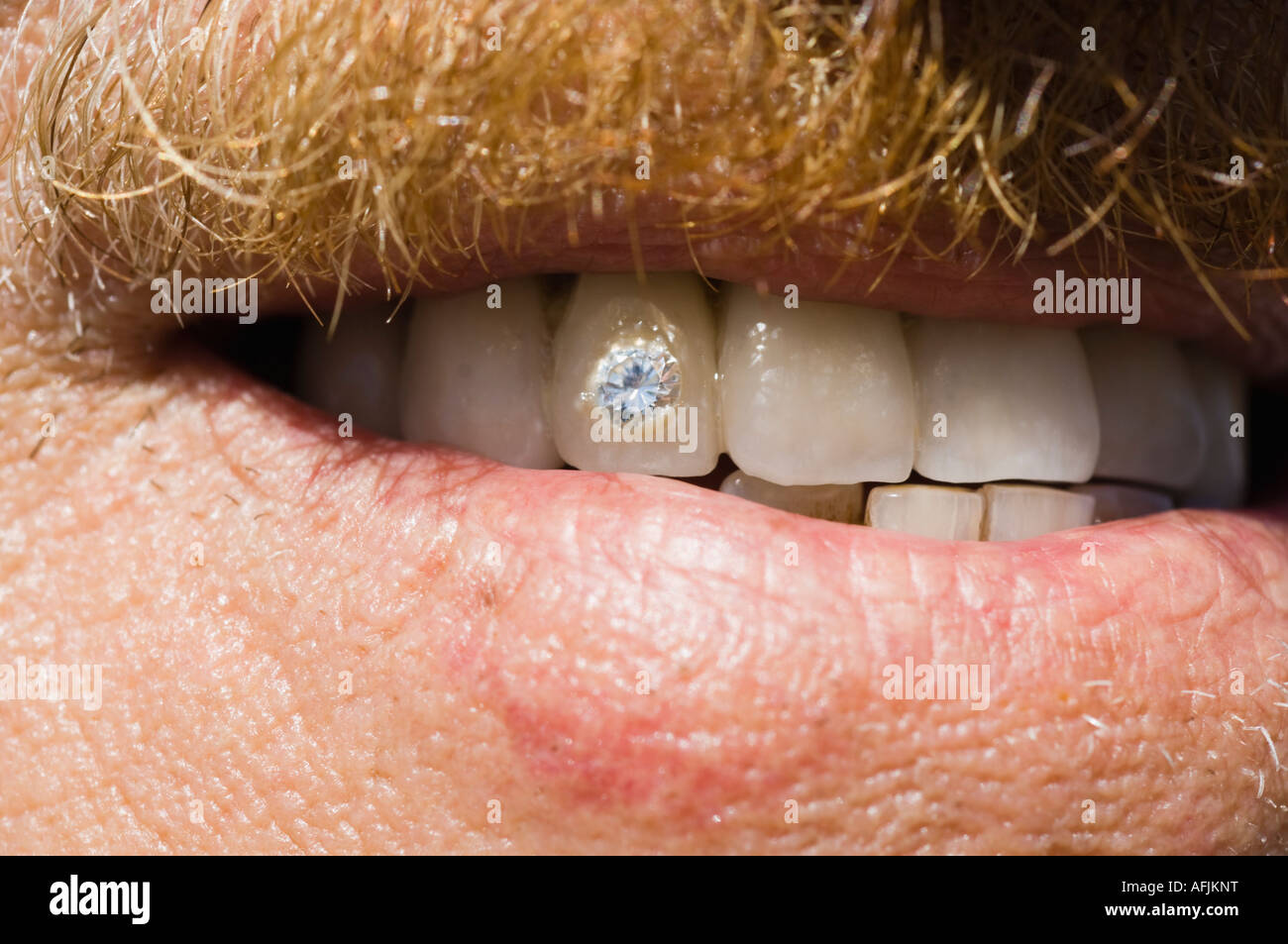 Tooth diamond Banque de photographies et d'images à haute résolution - Alamy