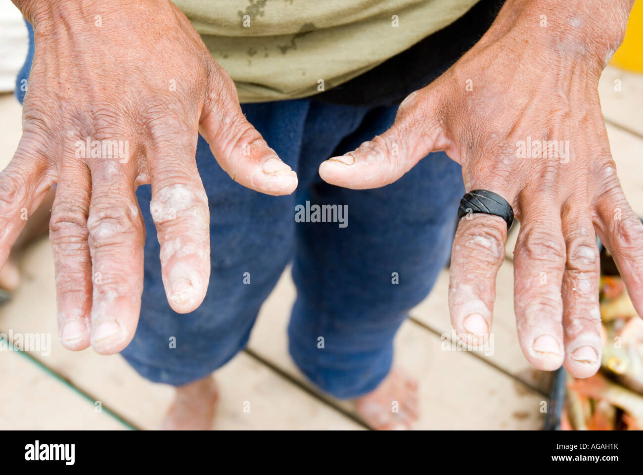 Un pêcheur montre sa main très usés. Banque D'Images
