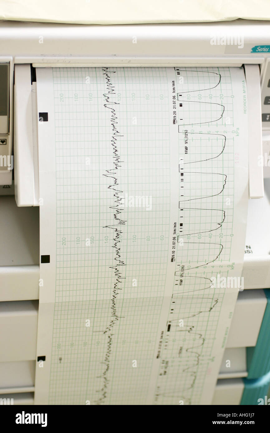 Ctg, cardiotocograph et son coeur et la contraction de l'enfant à naître Banque D'Images