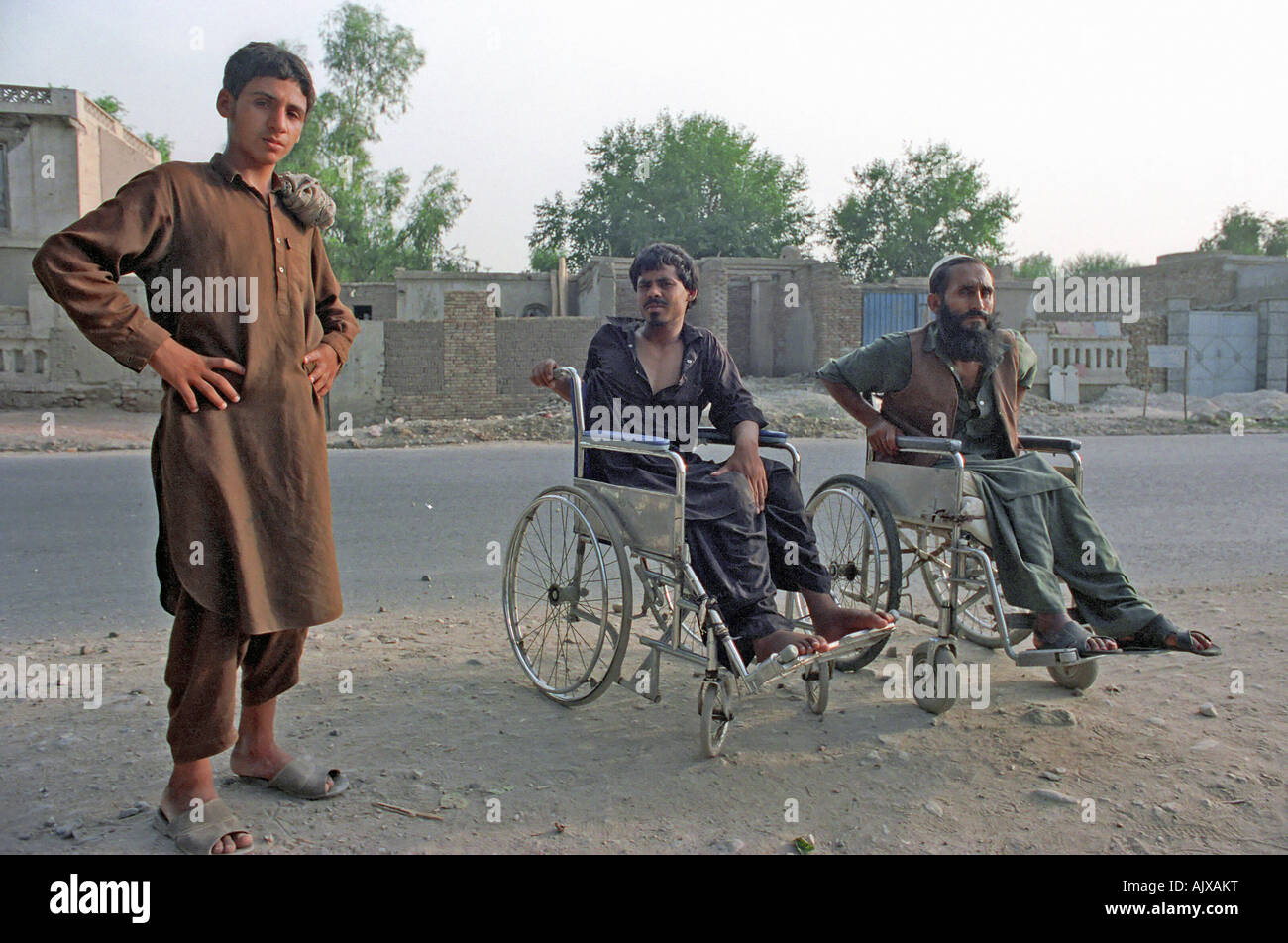 Les Afghans blessés dans la guerre avec les Soviétiques et le régime communiste, Banque D'Images