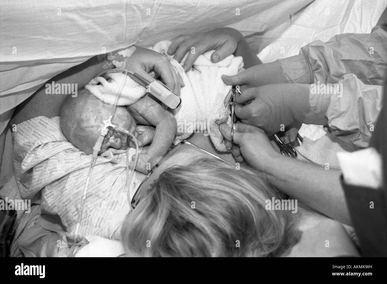 Baby Boy avec la mère, après avoir été par césarienne, environ 3 heures Banque D'Images