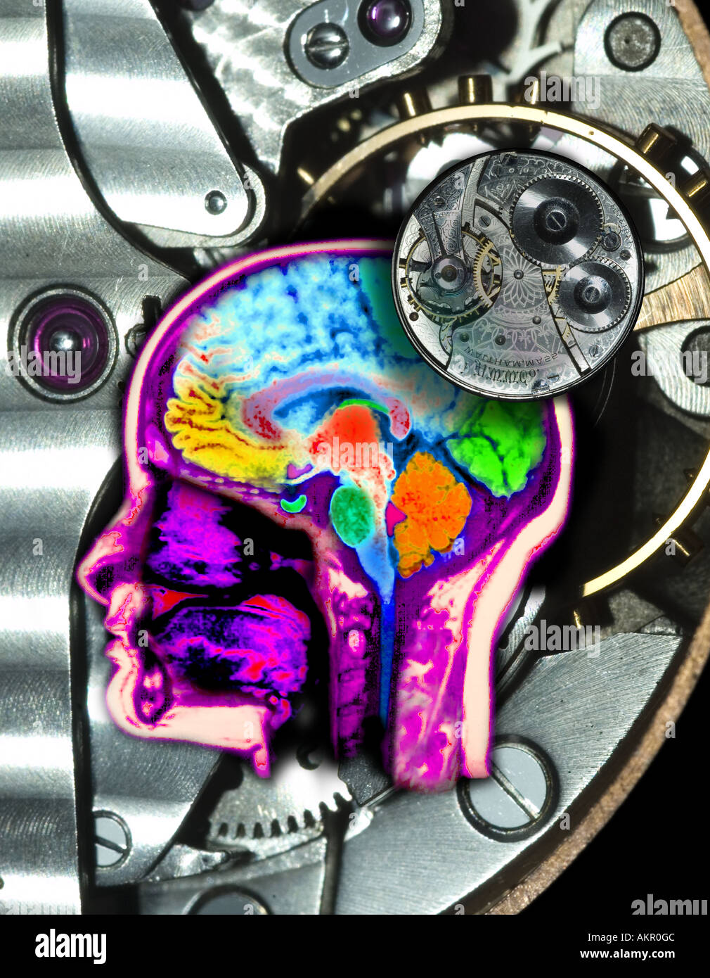 Analyse par résonance magnétique IRM de la tête renforcée de l'ordinateur et colorisées pour montrer l'anatomie normale du cerveau et chef overlai Banque D'Images