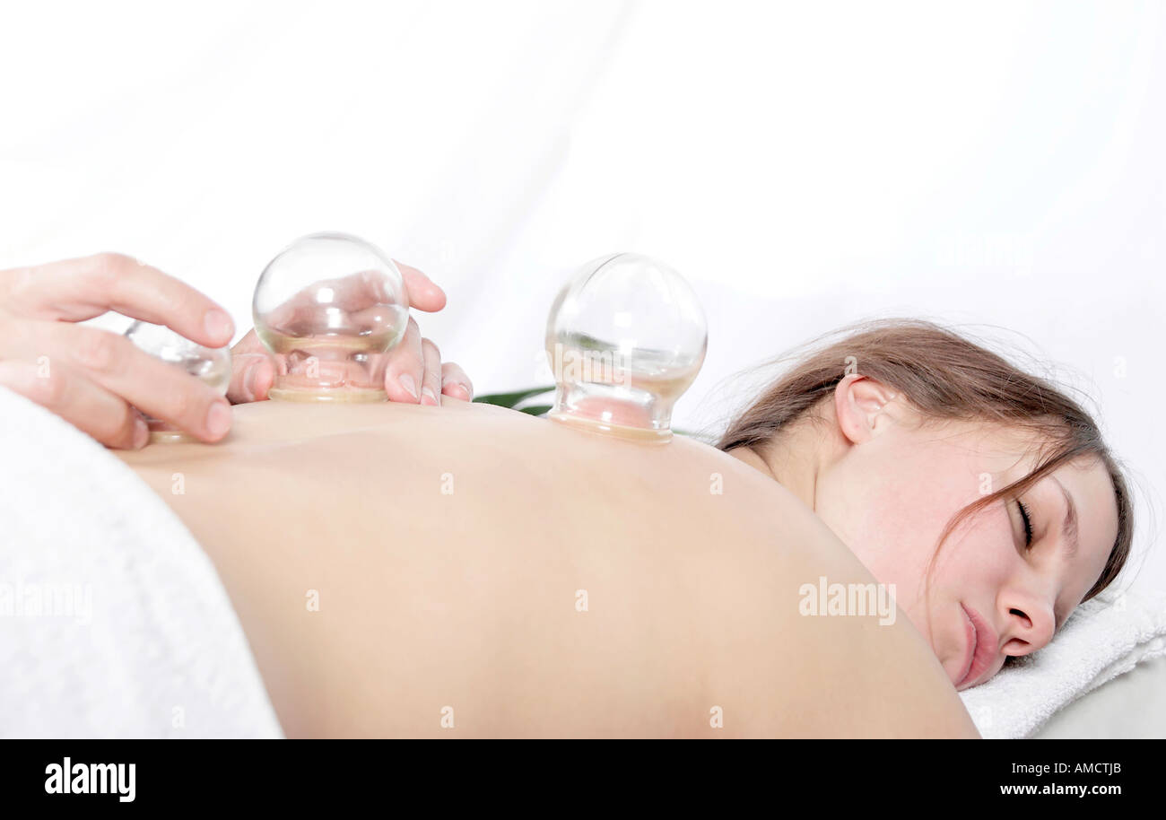 Young woman lying on bed recevant l'acupuncture en cornet Banque D'Images