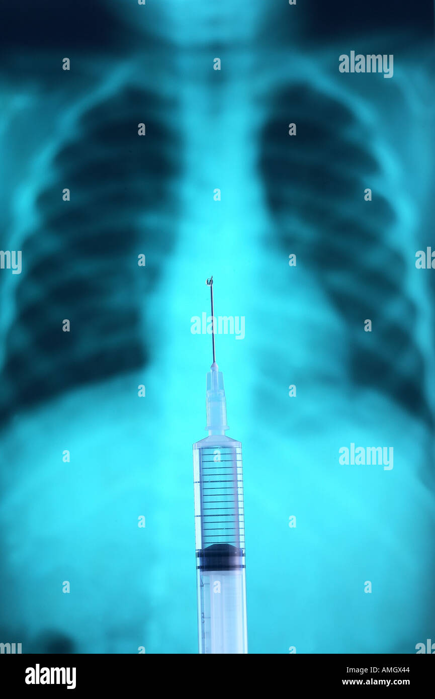 X-ray photo et une aiguille Banque D'Images