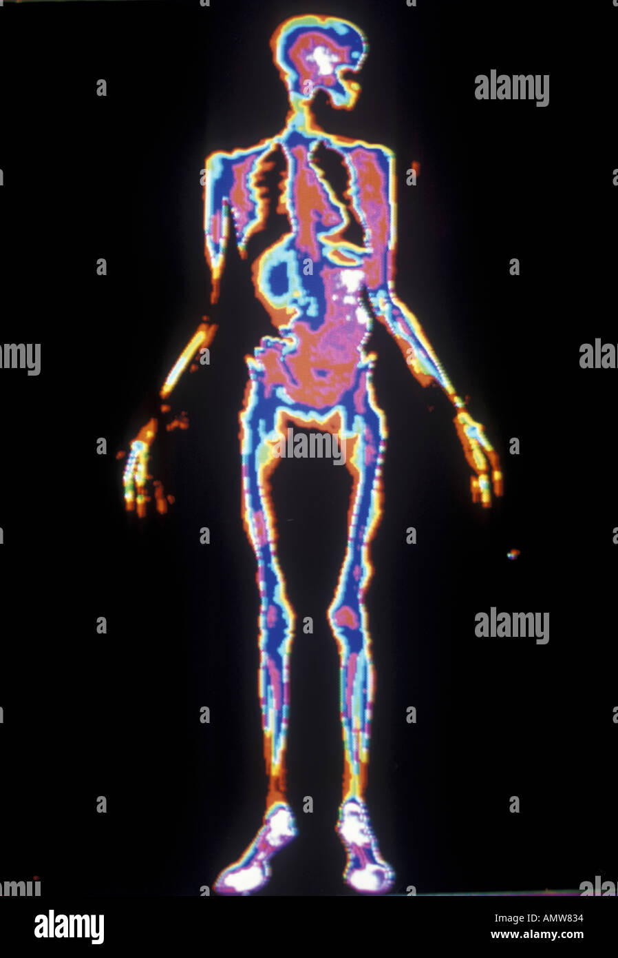 Nornal couleur x ray femme Banque D'Images