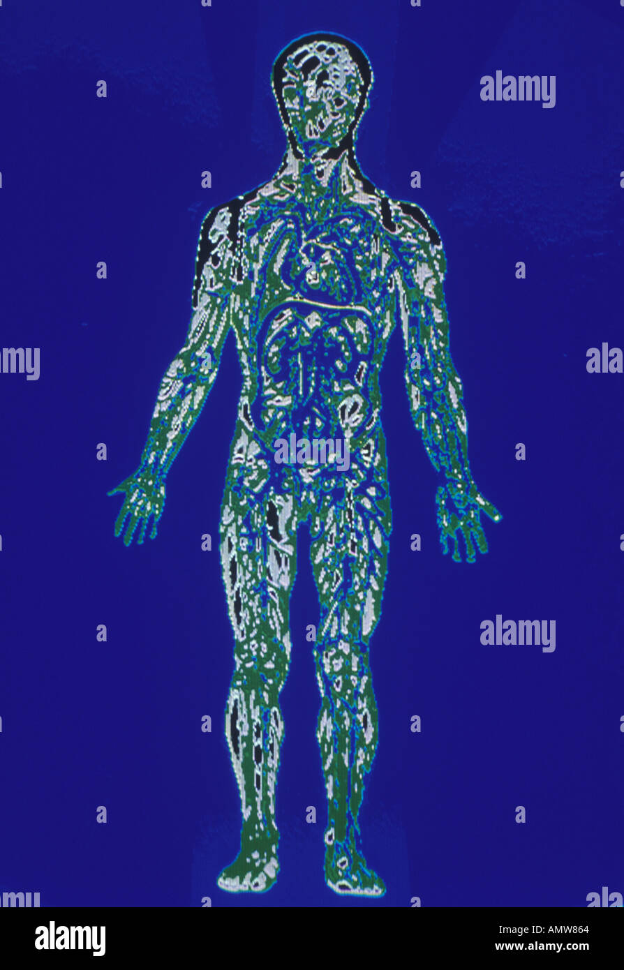 La couleur normale x ray homme Banque D'Images