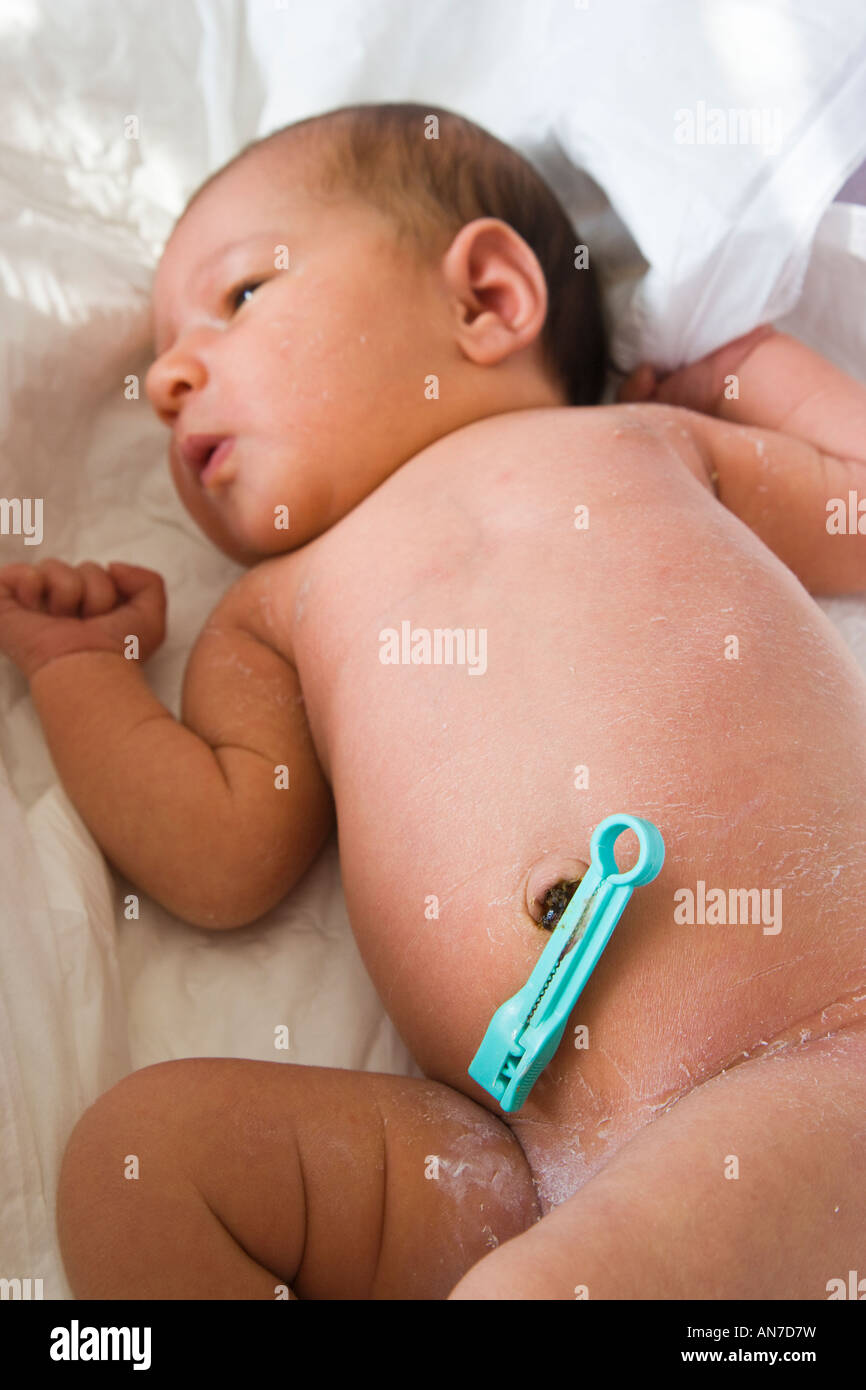 Femme De La Semaine Avec Bebe Collier Cordon Ombilical Photo Stock Alamy