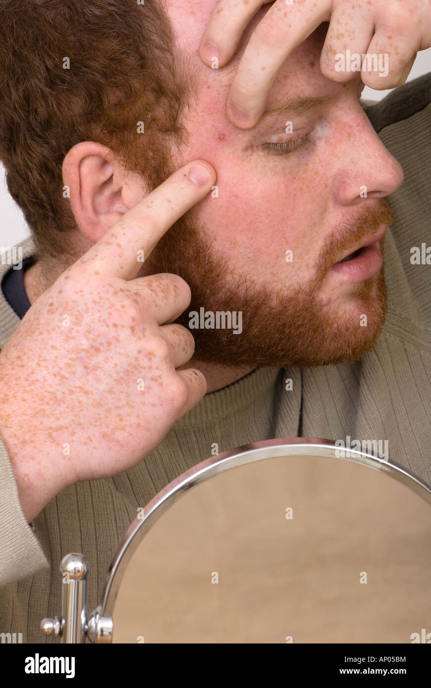 homme pressant un bouton de zit tache whitehead sur son visage Banque D'Images