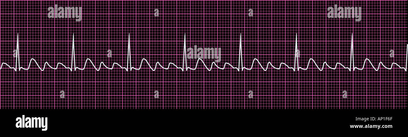 Électrocardiogramme ECG Banque D'Images