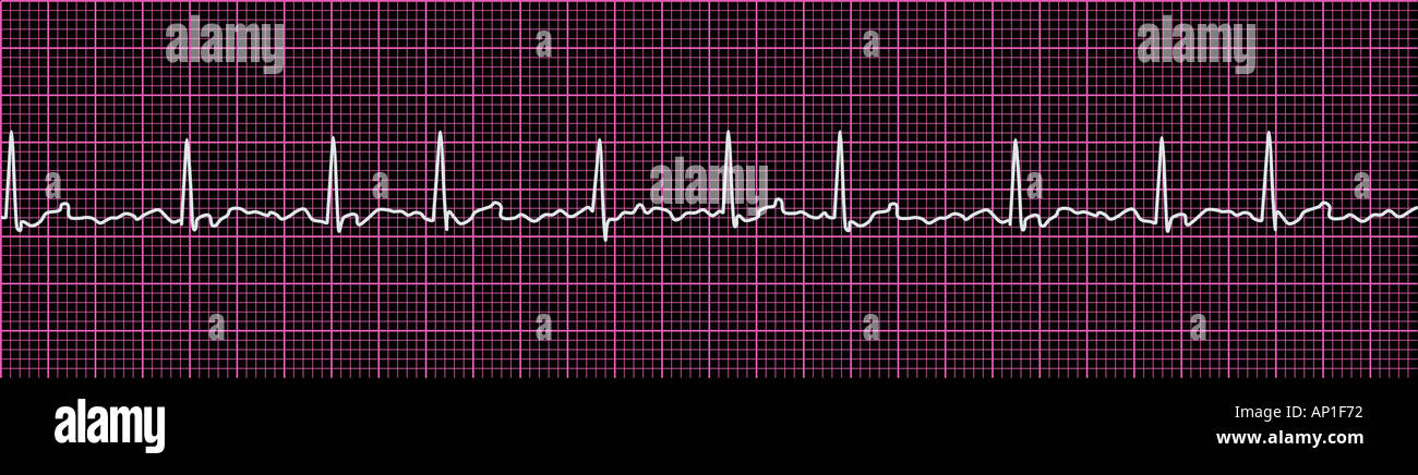 Électrocardiogramme ECG Banque D'Images