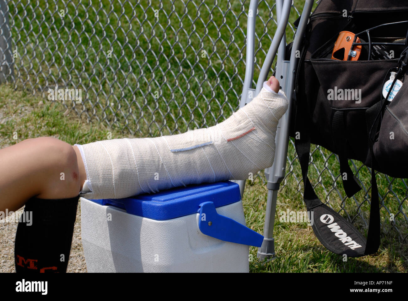Softball féminin les entorses de cheville blessures sportives en raison de  jouer au baseball Photo Stock - Alamy