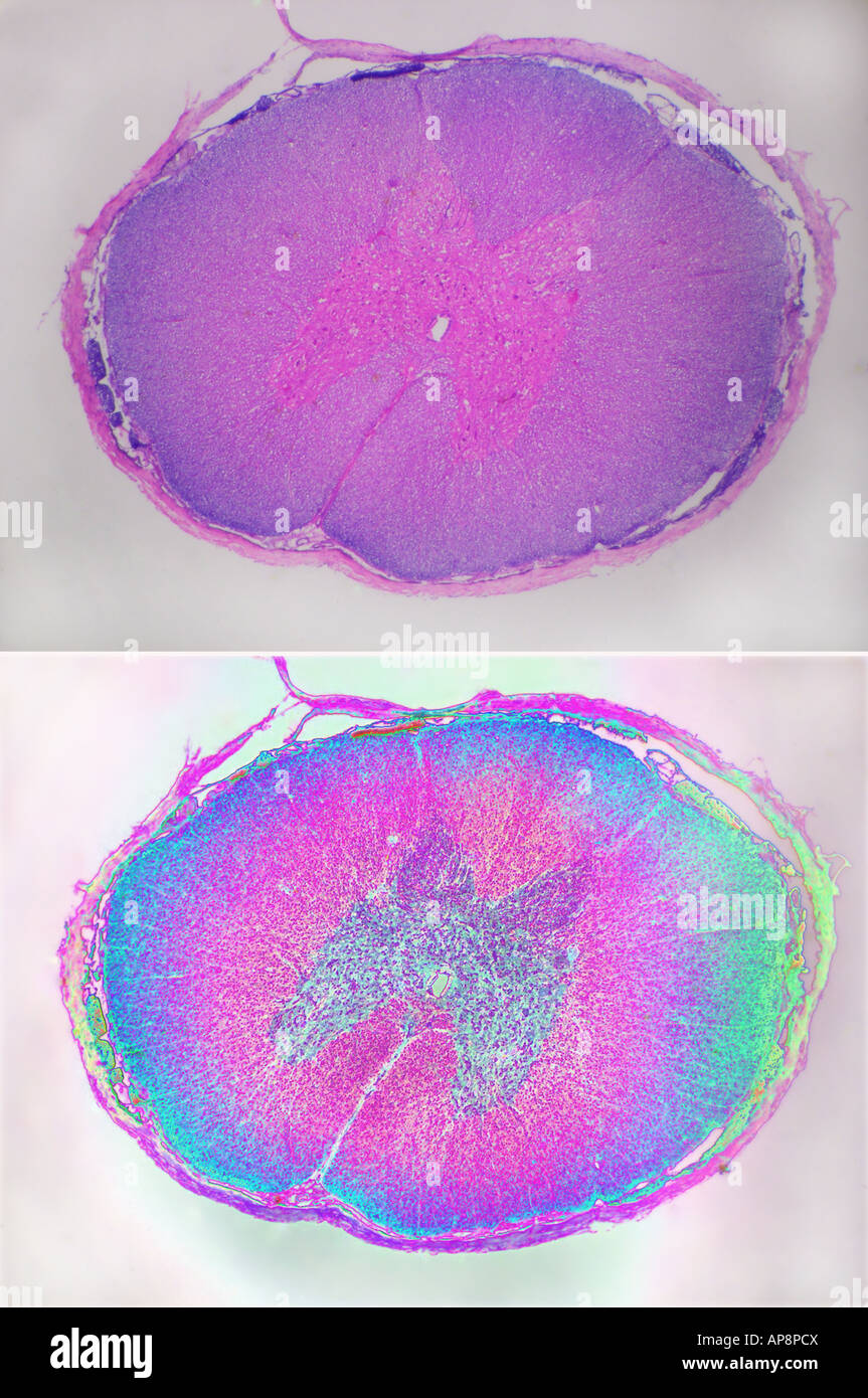 Moelle épinière CS-N5516-comparative des vues Banque D'Images