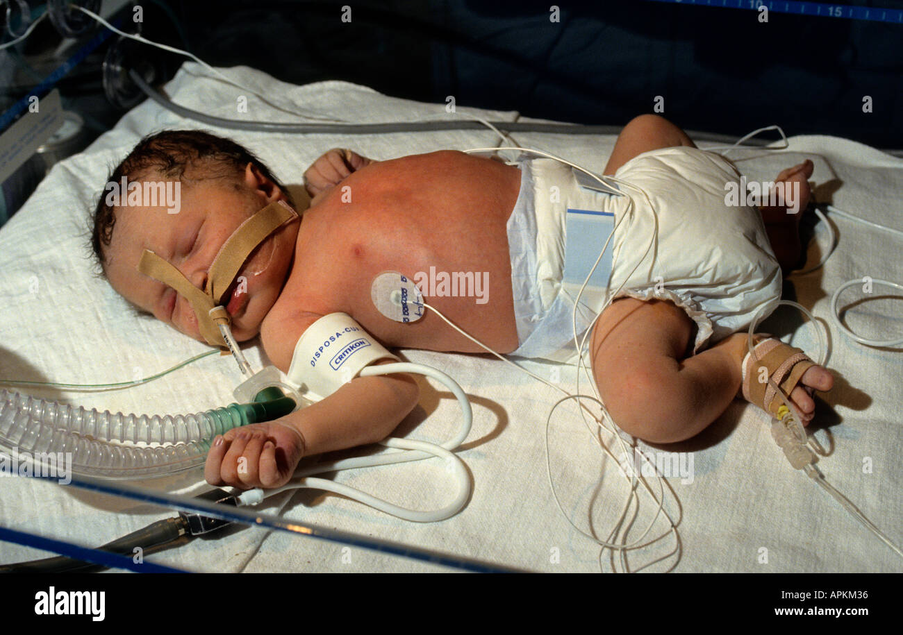 Bébé prématuré de l'incubateur de soins intensifs de l'hôpital Banque D'Images