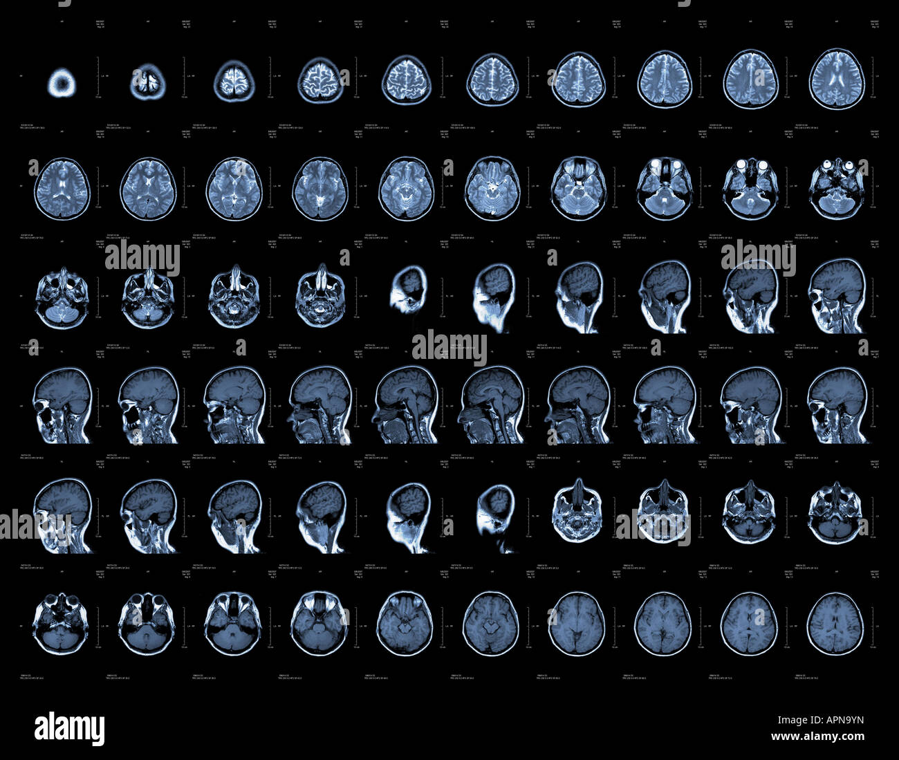 Cerveau et les images scanner ou IRM de la tête Banque D'Images