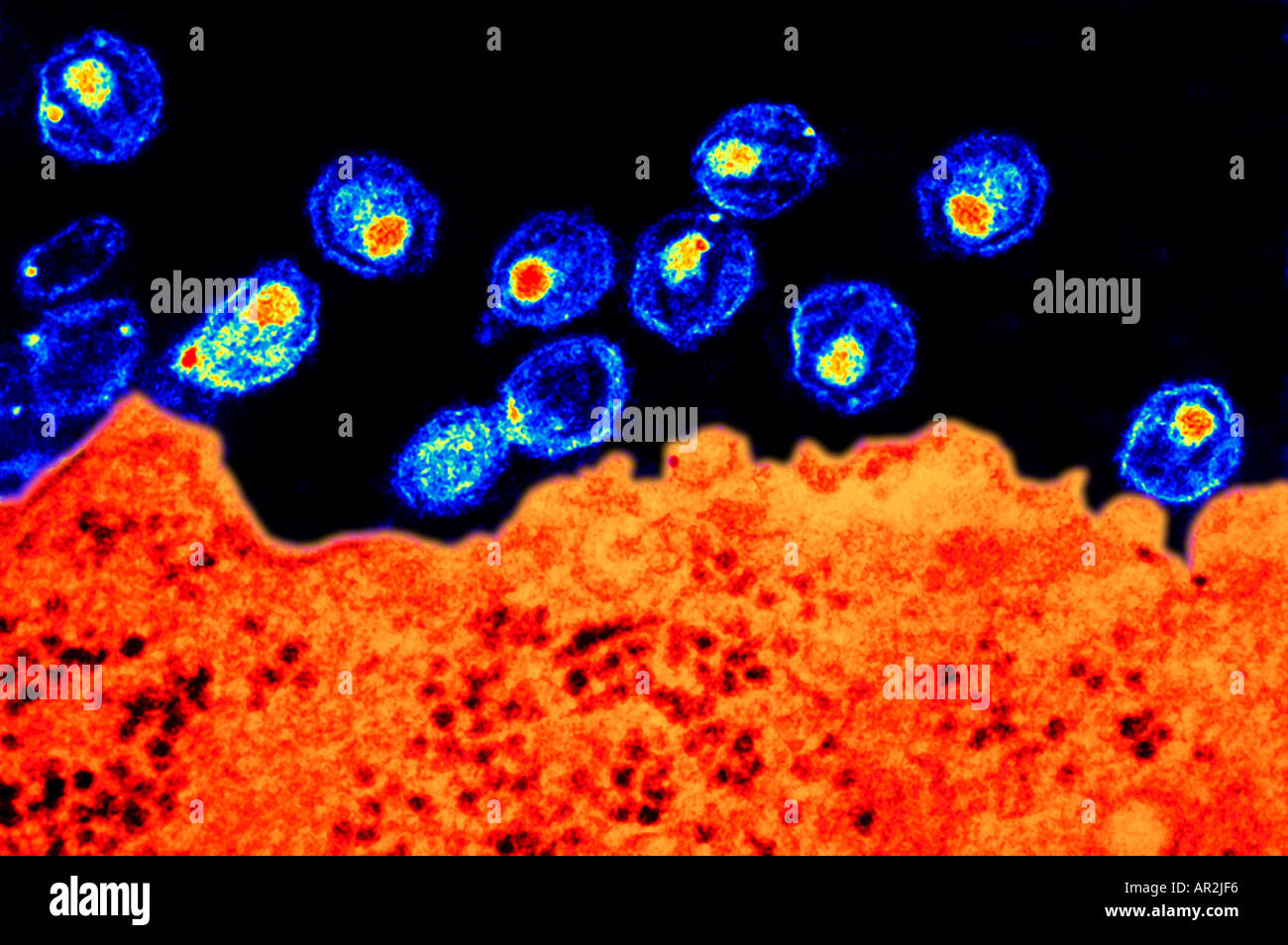 Microscope Electronique A Transmission Tem Du Virus Du Sida Photo Stock Alamy