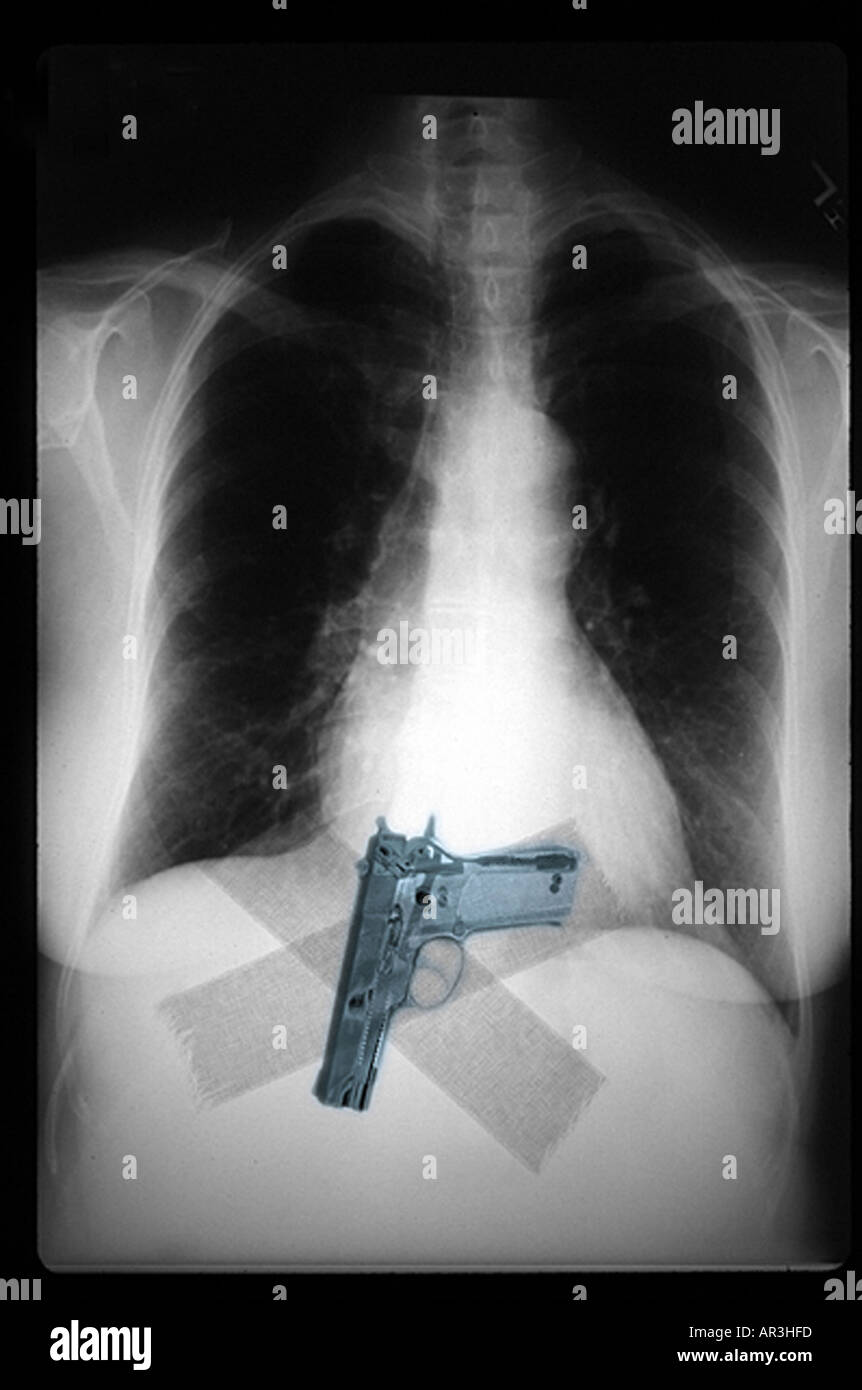 La sécurité de l'aéroport simulé xray montrant un Smith et Wesson 9mm pistolet collé sur une personne de sa taille Banque D'Images
