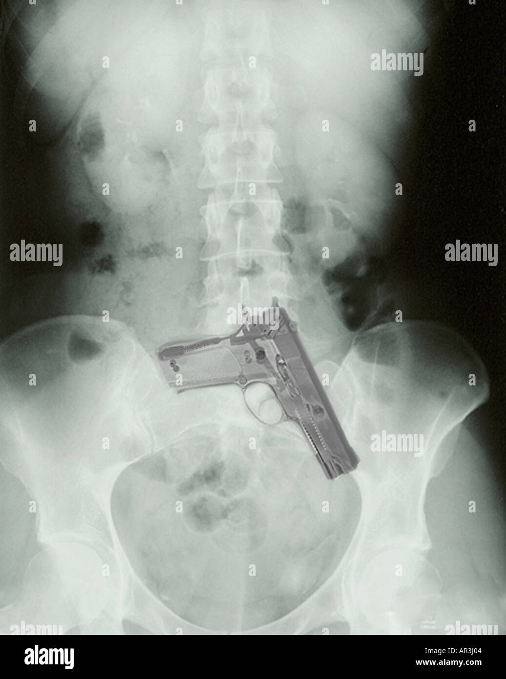 Photomontage abdomen xray avec Smith et Wesson 9mm pistolet Banque D'Images