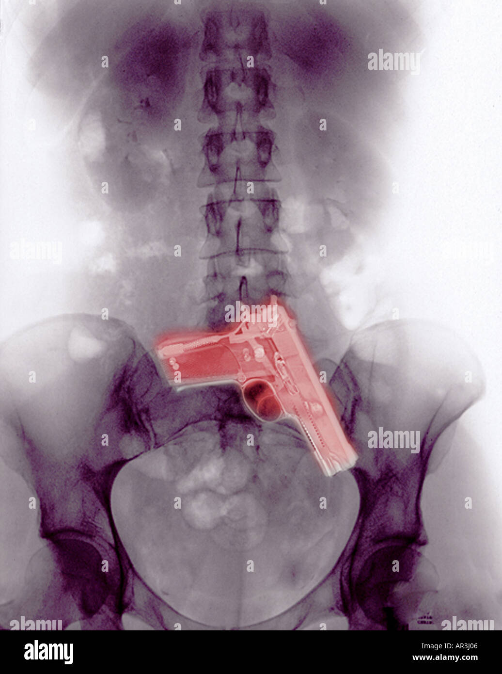 Photomontage abdomen xray avec Smith et Wesson 9mm pistolet Banque D'Images