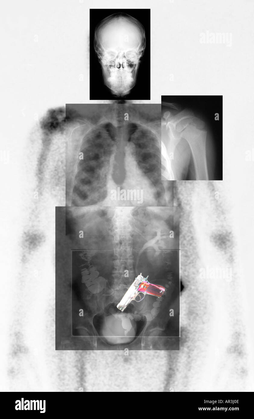 La sécurité de l'aéroport simulé xray montrant un Smith et Wesson 9mm