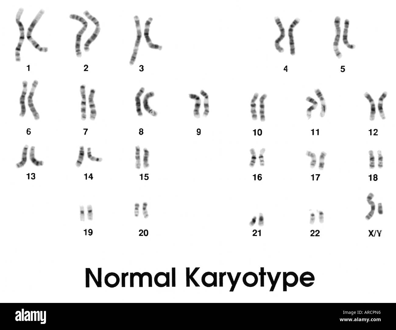 chromosomes-masculins-normaux-banque-de-photographies-et-d-images