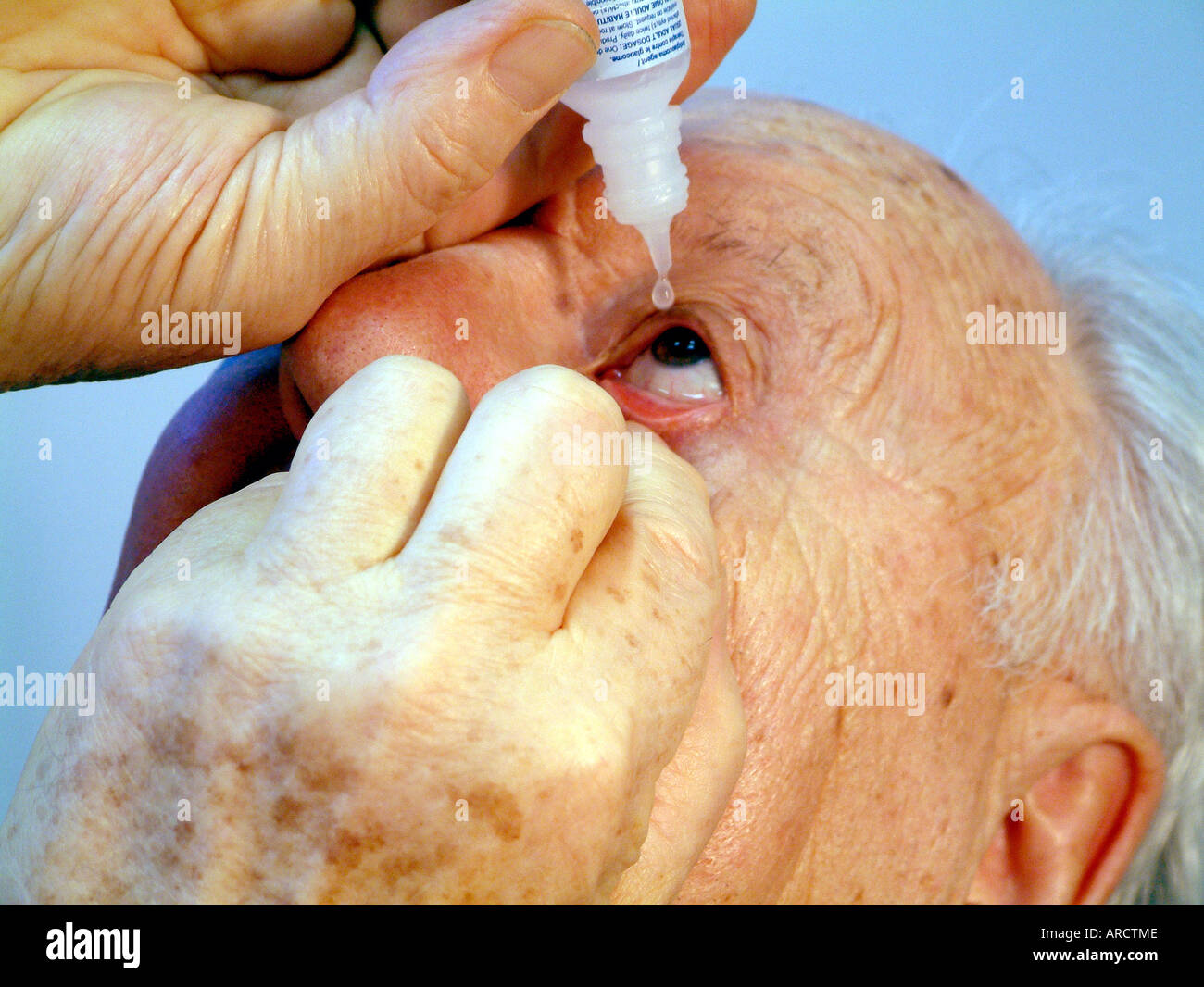 C'est une photographie d'un homme âgé l'administration de gouttes pour les yeux. Banque D'Images