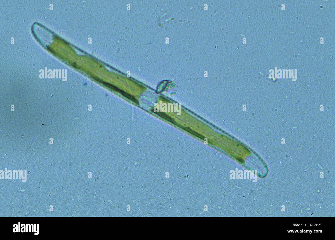 Algues diatomées Seawed microscopie optique Banque D'Images