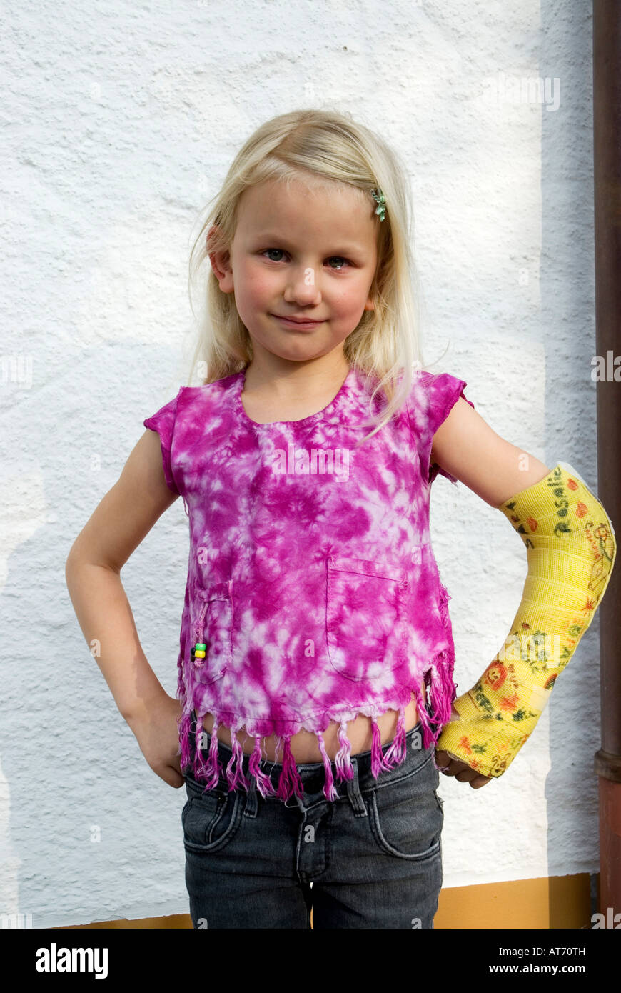 Portrait d'une fille avec un bras cassé Banque D'Images