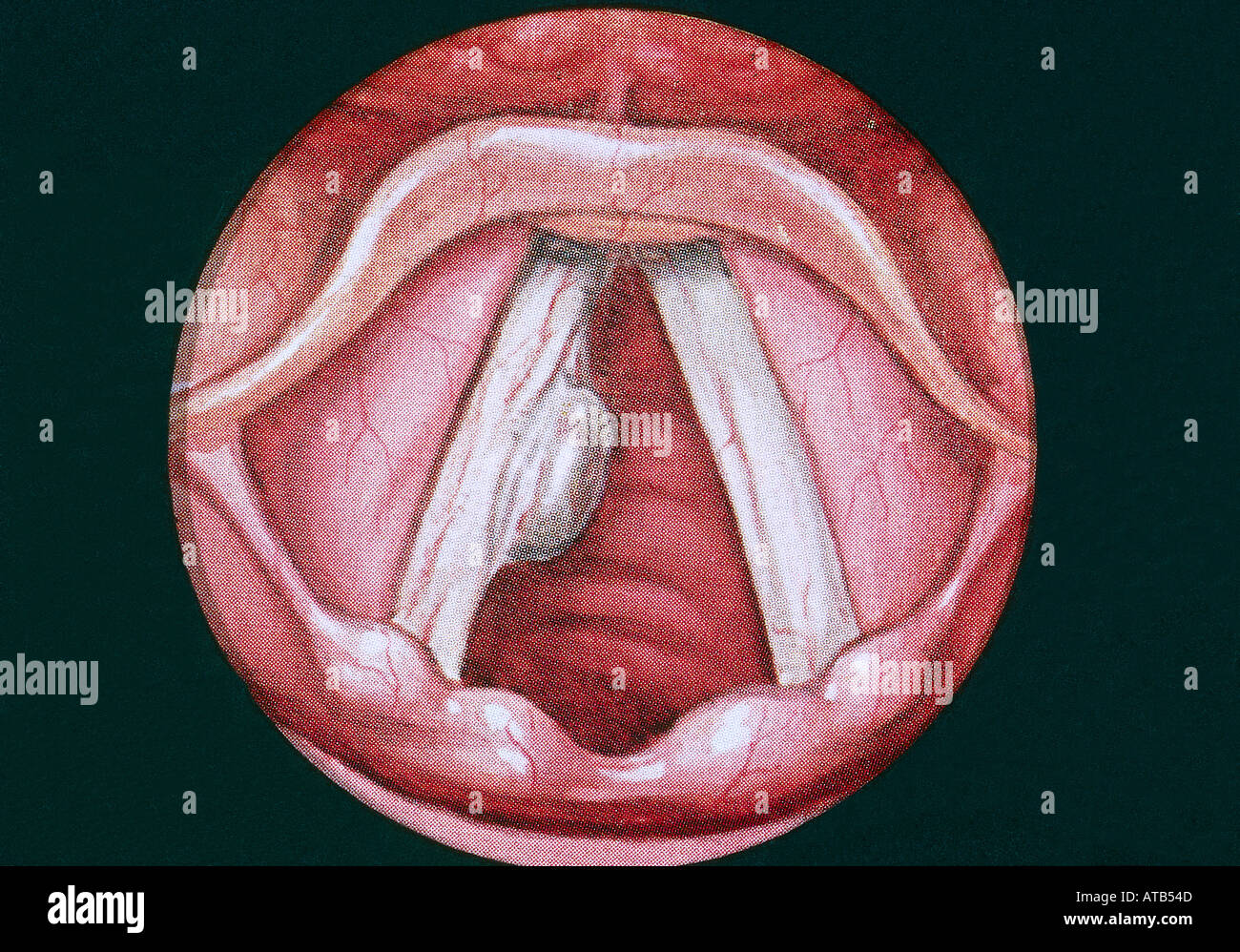Cordes vocales et du larynx Banque de photographies et d’images à haute ...