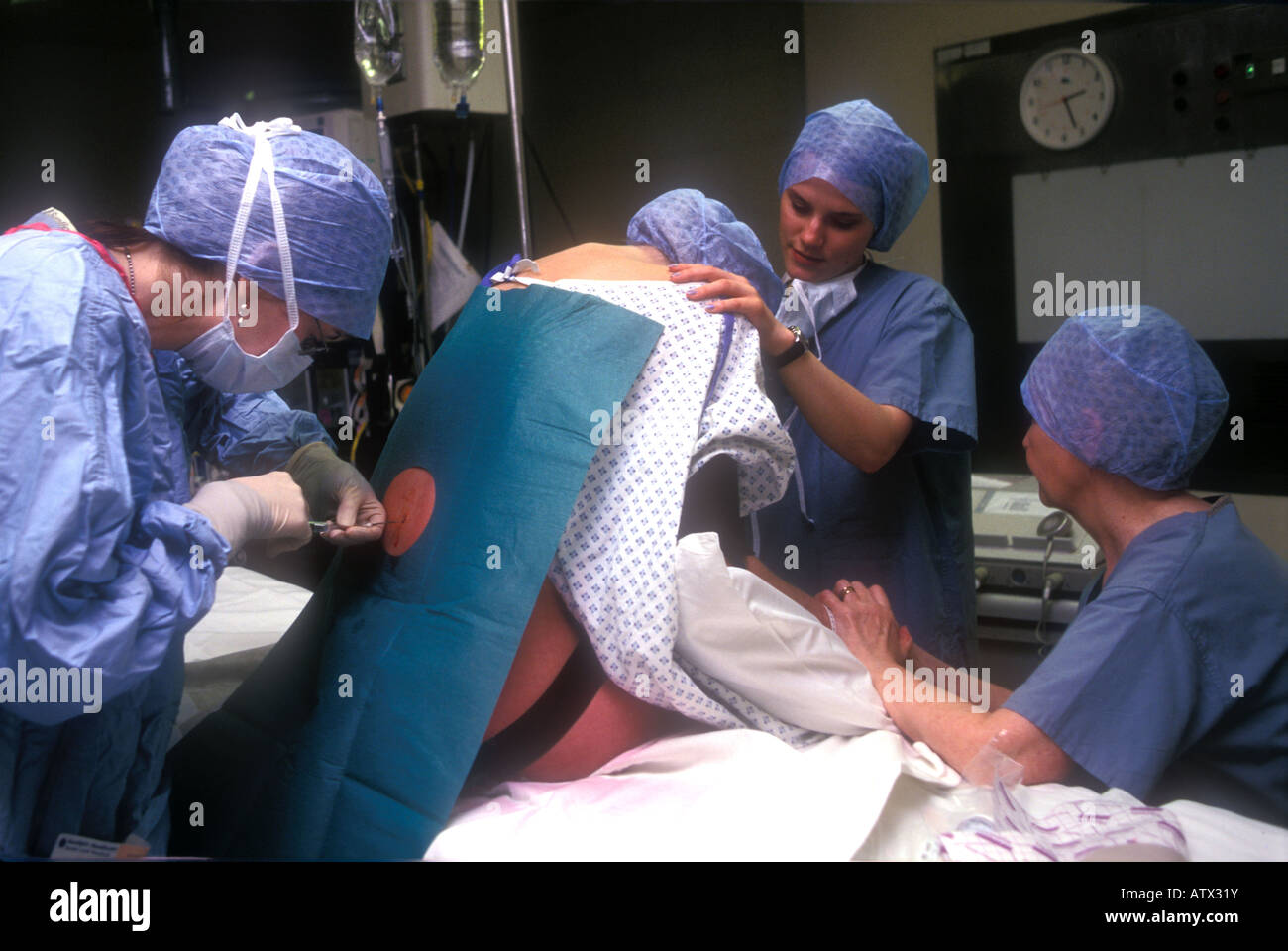 L'épidurale donnée à une femme pour le soulagement de douleur pendant l'accouchement de la Reine-Charlotte Hospital London Banque D'Images