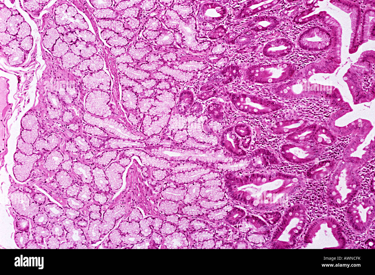 Glandes de brunner Banque de photographies et d’images à haute