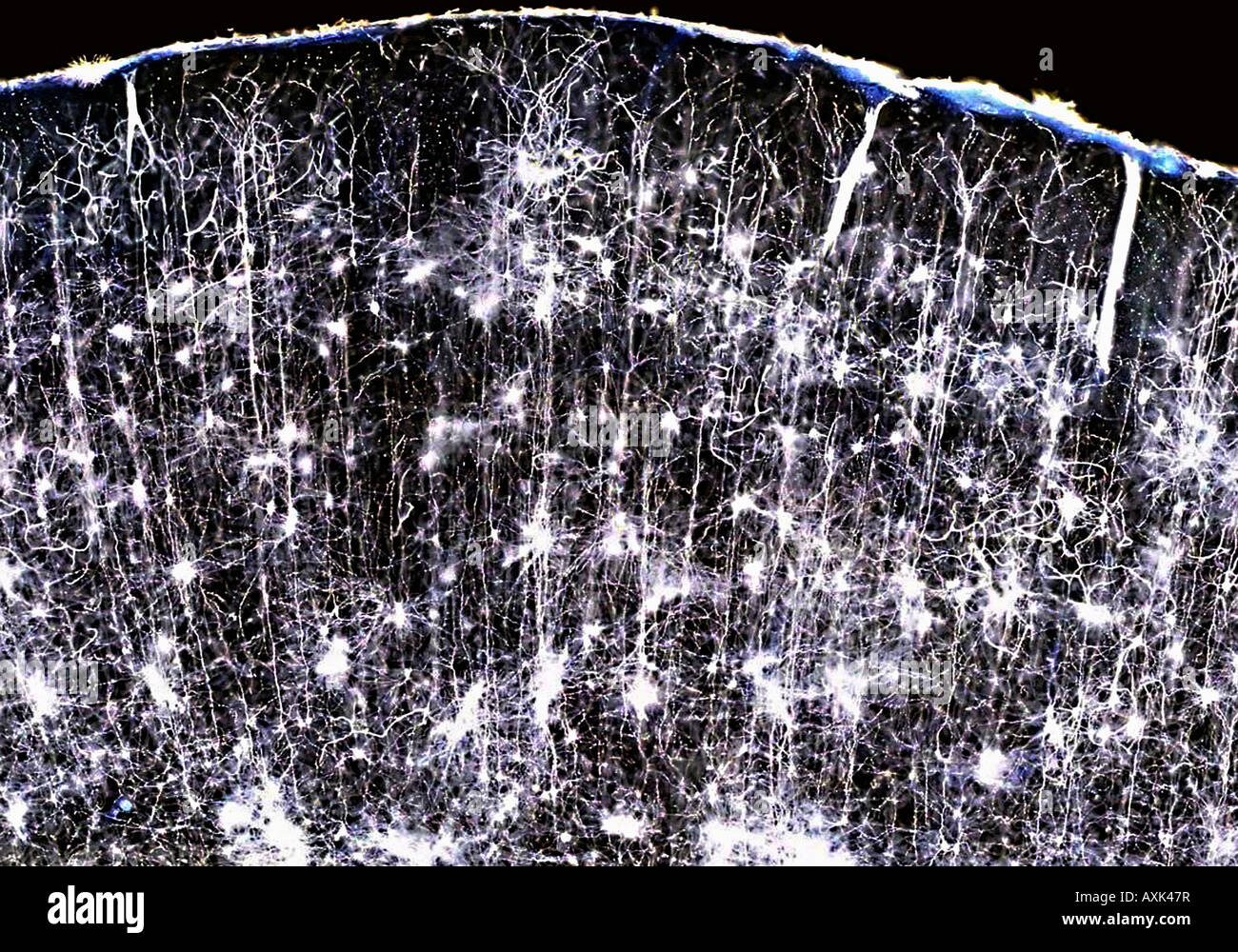 Intersection des tissus du cerveau par microscopie optique Banque D'Images