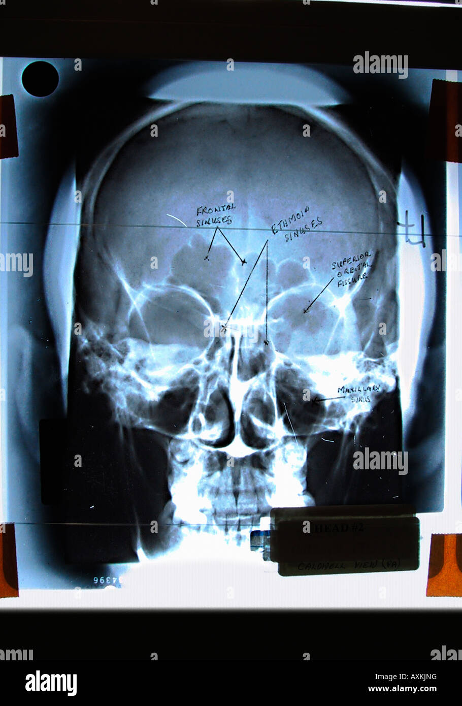 x-ray de scull Banque D'Images