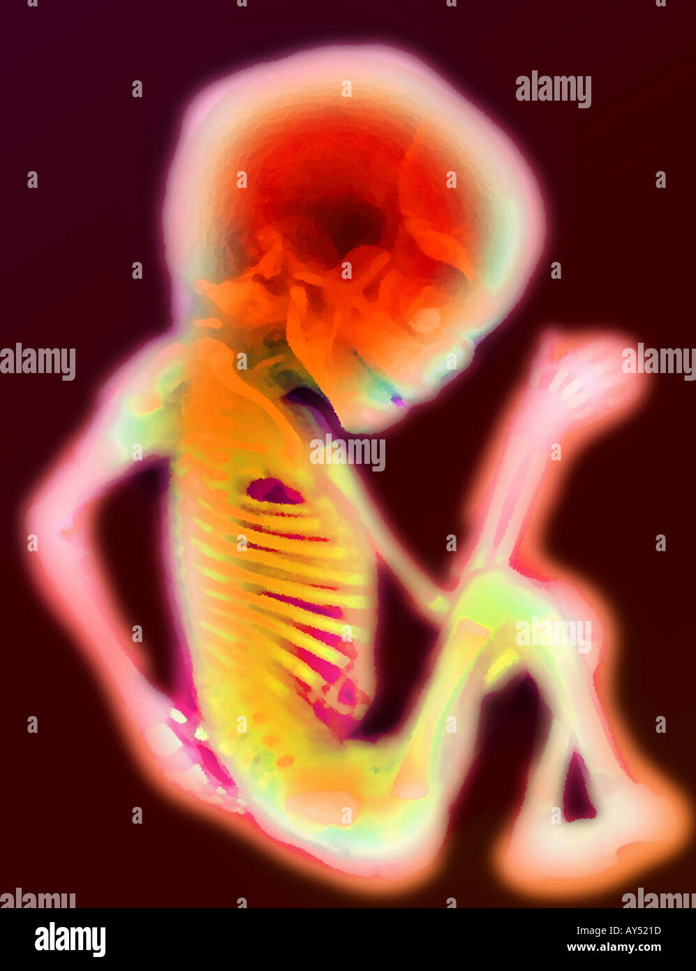 L'amélioration de l'ordinateur photo d'un foetus humain à 14 semaines Banque D'Images