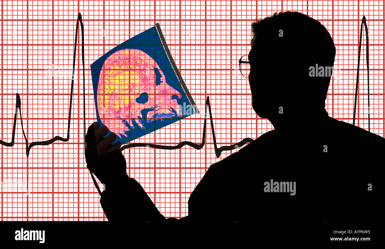 Vue conceptuelle du médecin l'étude de la couleur de transparence d'un crâne avec un électrocardiogramme électrocardiogramme afficher en arrière-plan Banque D'Images