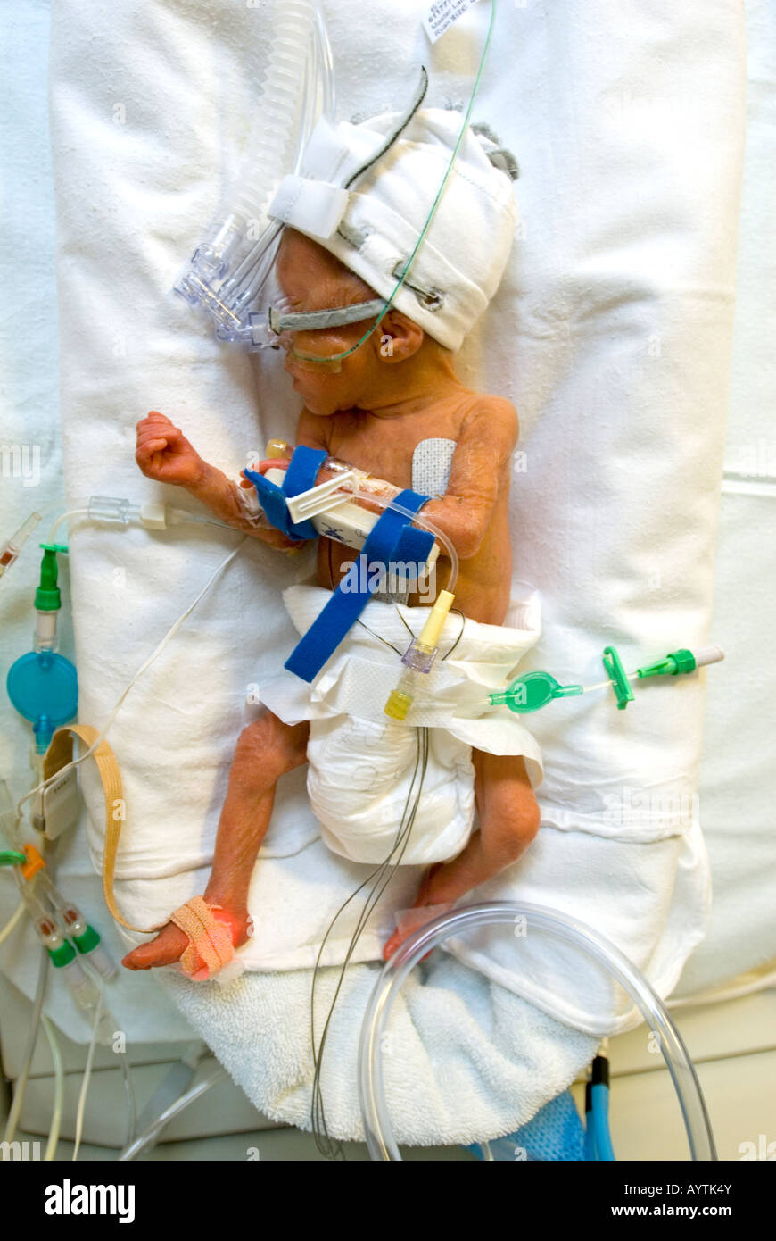 Bebe Premature En Couveuse Photo Stock Alamy