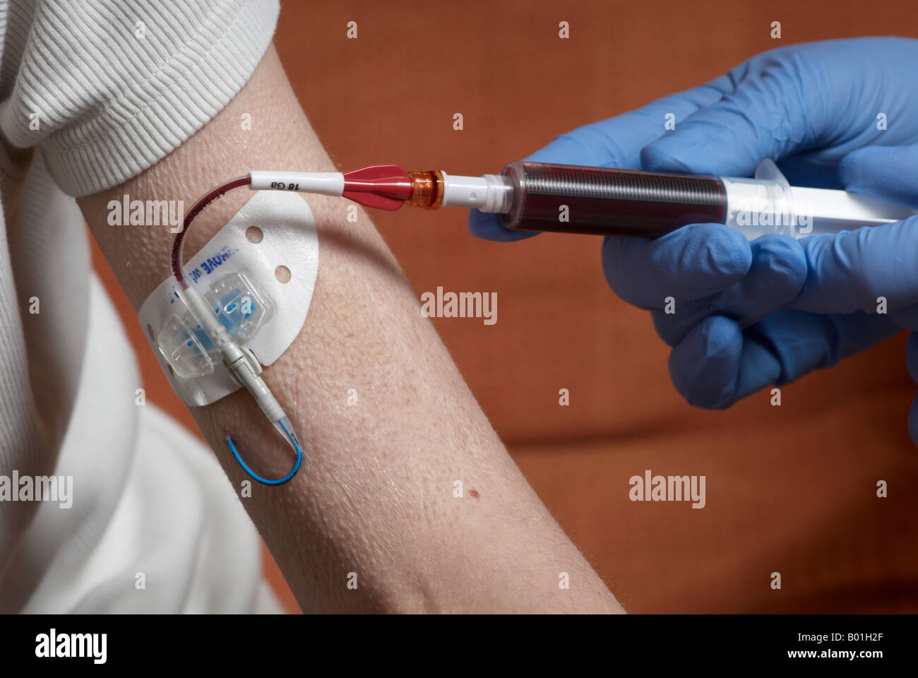 Une prise de sang un pic line avec des gants chirurgicaux (cathéter central  à insertion périphérique Photo Stock - Alamy