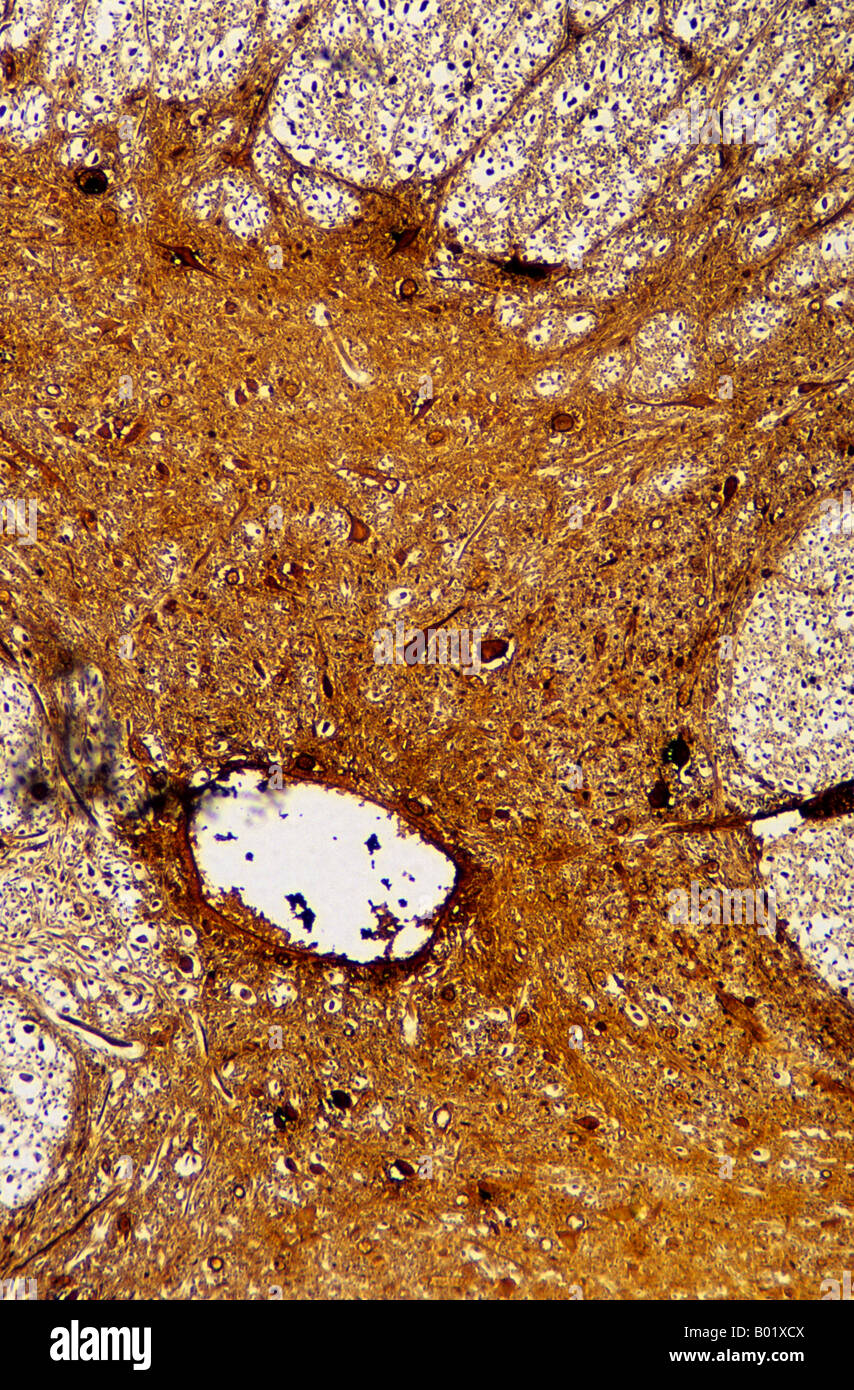 Neurone multipolaire du tissu nerveux de la moelle épinière Banque D'Images