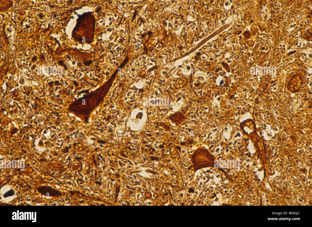 Neurone multipolaire du cordon médullaire tissu nerveux central 140x Banque D'Images