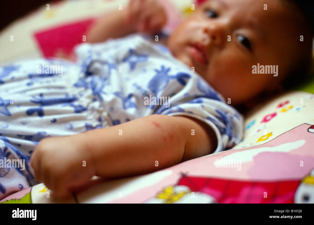 4 Mois Bebe Garcon Avec 3 Piqures De Moustique Sur Son Bras Bebe Est La Moitie Et La Moitie De L Asie Caucasian Photo Stock Alamy 4 Mois Bebe Garcon Avec 3 Piqures De Moustique Sur Son Bras Bebe Est La Moitie Et La Moitie De L Asie Caucasian Photo Stock Alamy