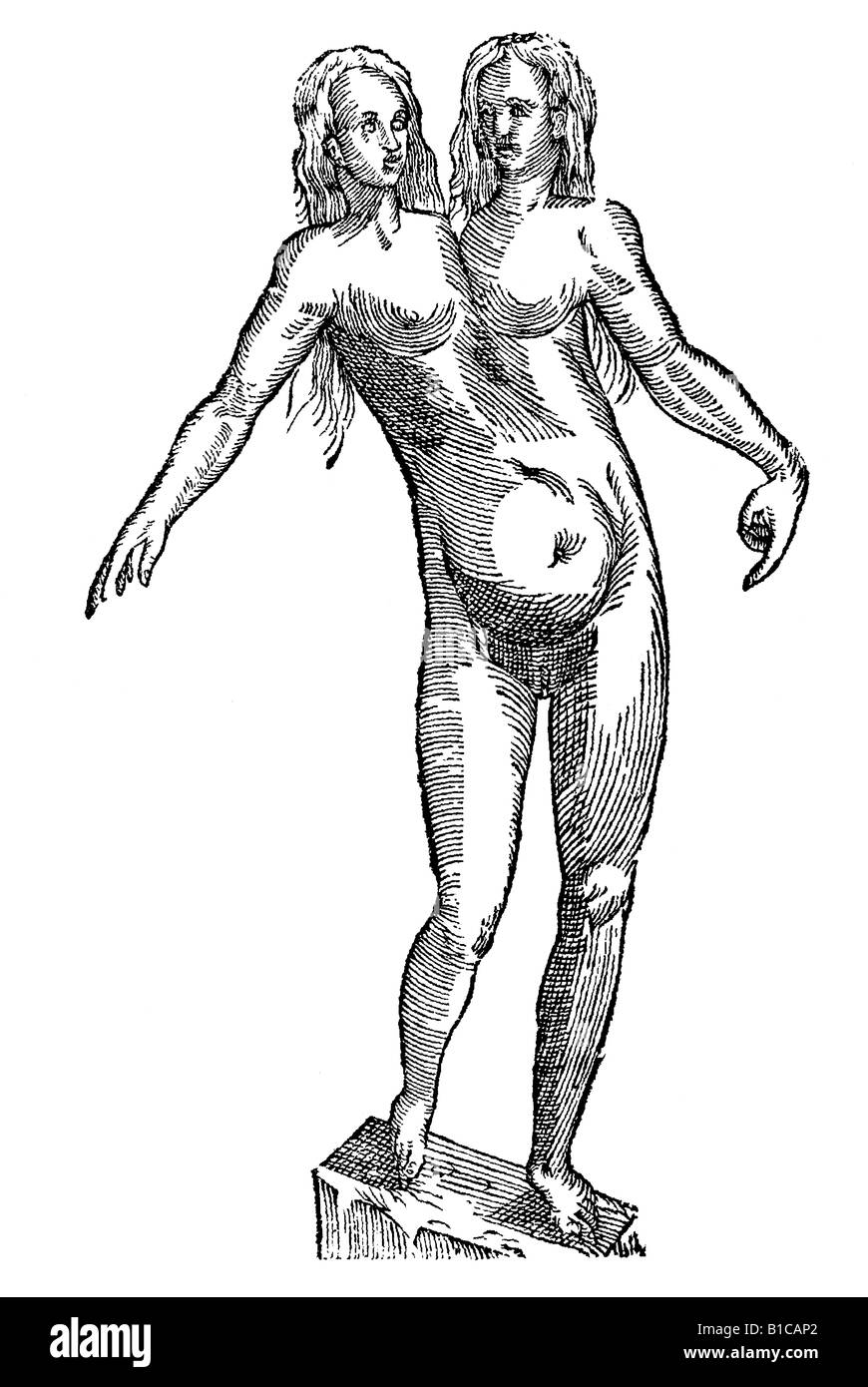 Puellae icône bicipitis Aldrovandi 1642 17e siècle l'Europe de la renaissance Banque D'Images