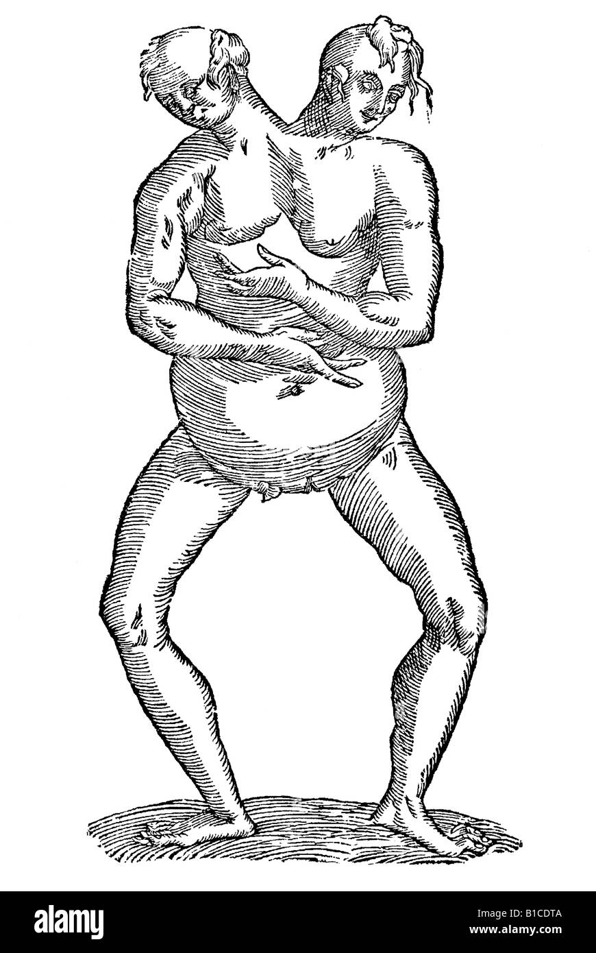 Monstrum hermaphroditicum biceps aliud Aldrovandi 1642 17e siècle l'Europe de la renaissance Banque D'Images