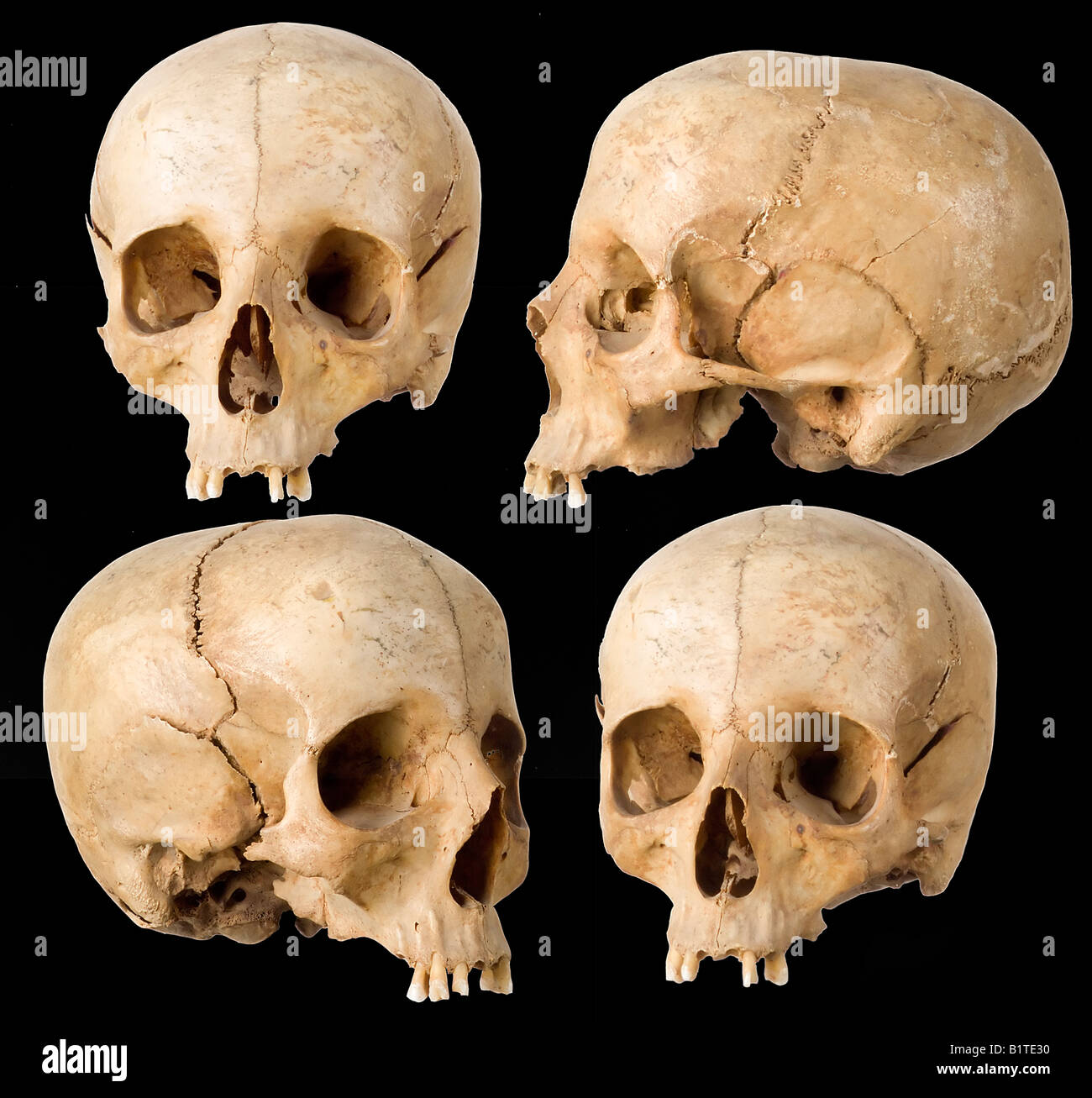 Crâne humain dans quatre angles sur fond noir Banque D'Images