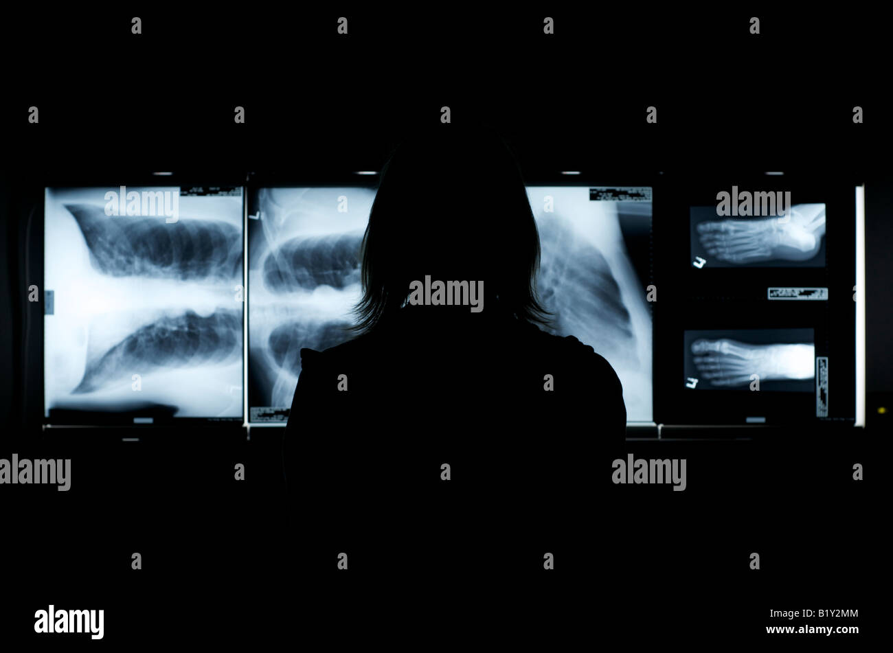 Dans scrubs infirmier stéthoscope avec examen de Xray. Silhouette shot. Banque D'Images