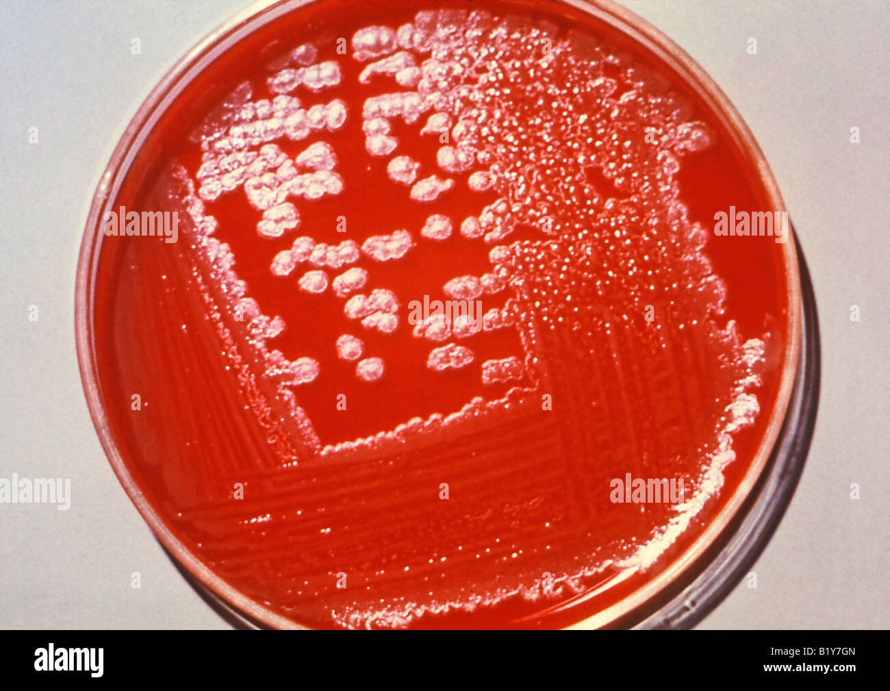 La culture sur gélose au sang de plus en plus de plaque Bacillus anthracis (anthrax) Banque D'Images