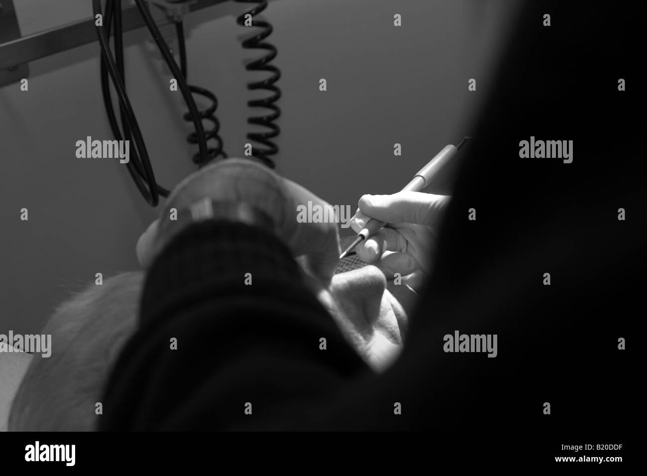 Médecin soigne patient au nez en noir et blanc Banque D'Images Médecin soigne patient au nez en noir et blanc Banque D'Images