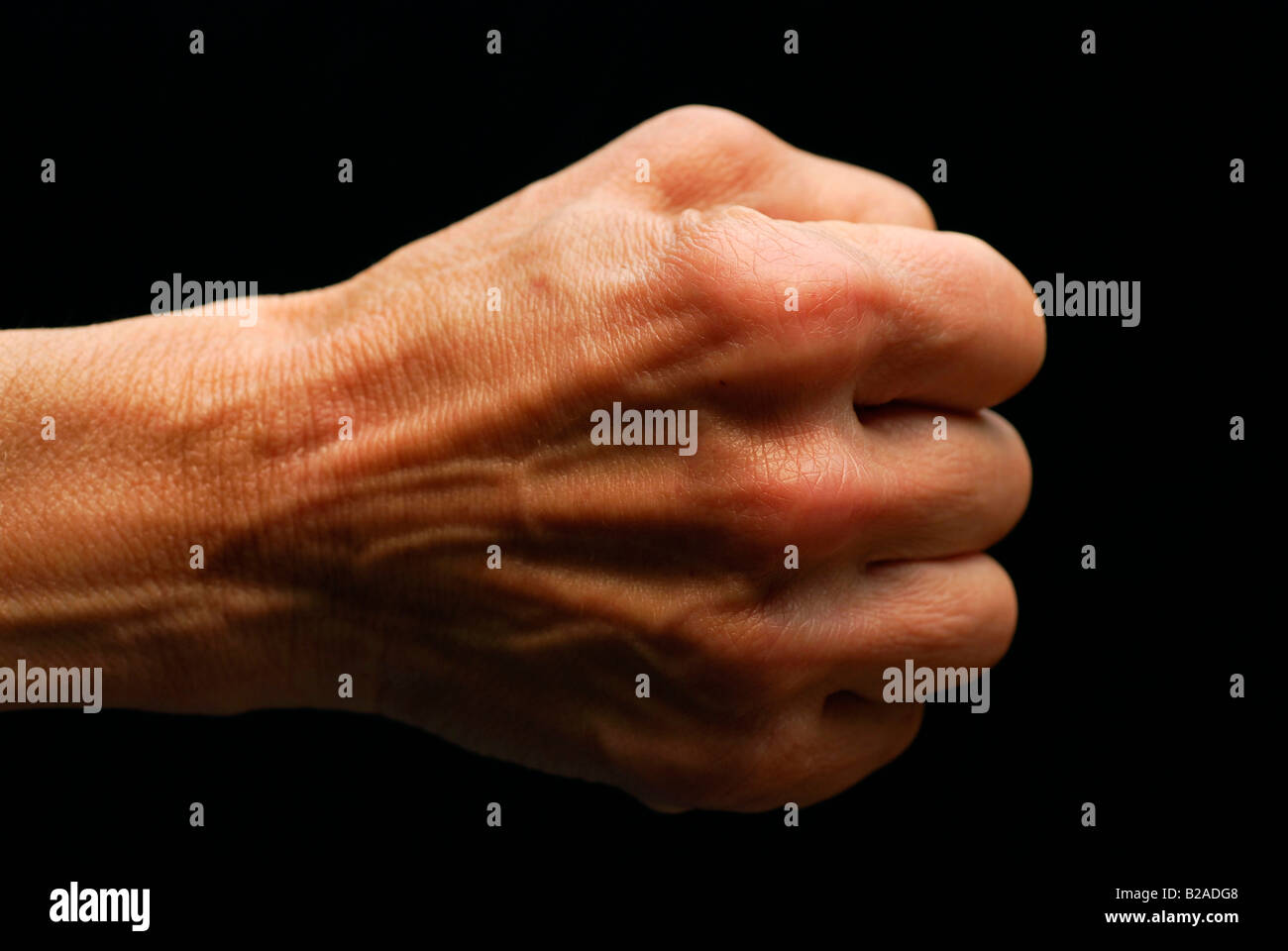 59-year-old woman's hand, symptômes de l'arthrite Banque D'Images