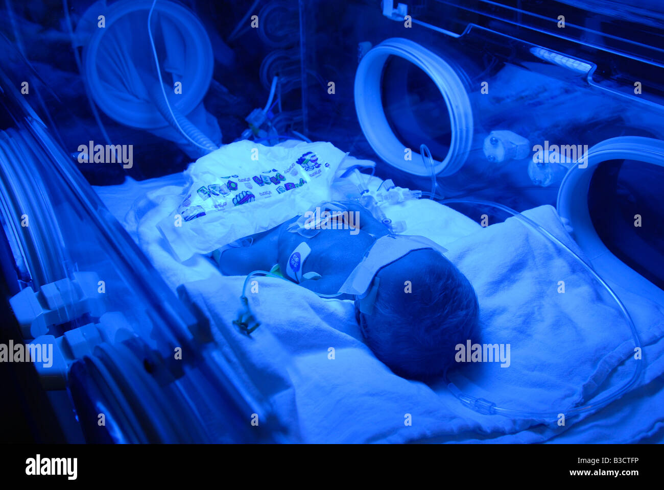 Un bébé prématuré à l'intérieur d'un incubateur à l'unité de soins intensifs néonatals du centre médical Shaare Zedek ou de l'hôpital Shaarei Tzedek, à Jérusalem-Ouest Banque D'Images