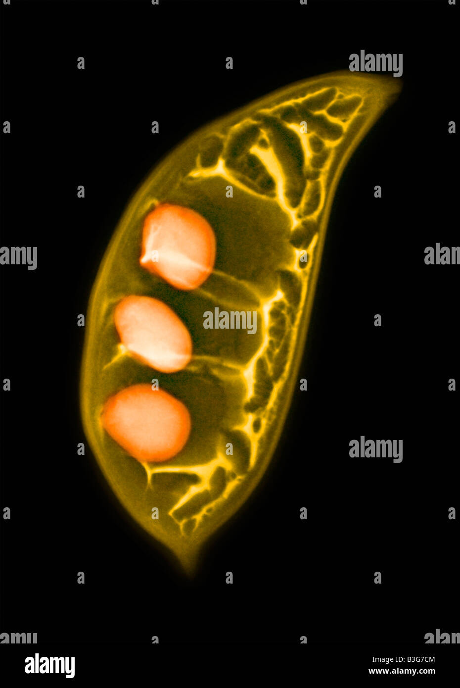 X ray colorisée des gousses d'un kentucky coffee bean Gymnocladus dioica de la famille des légumineuses Banque D'Images