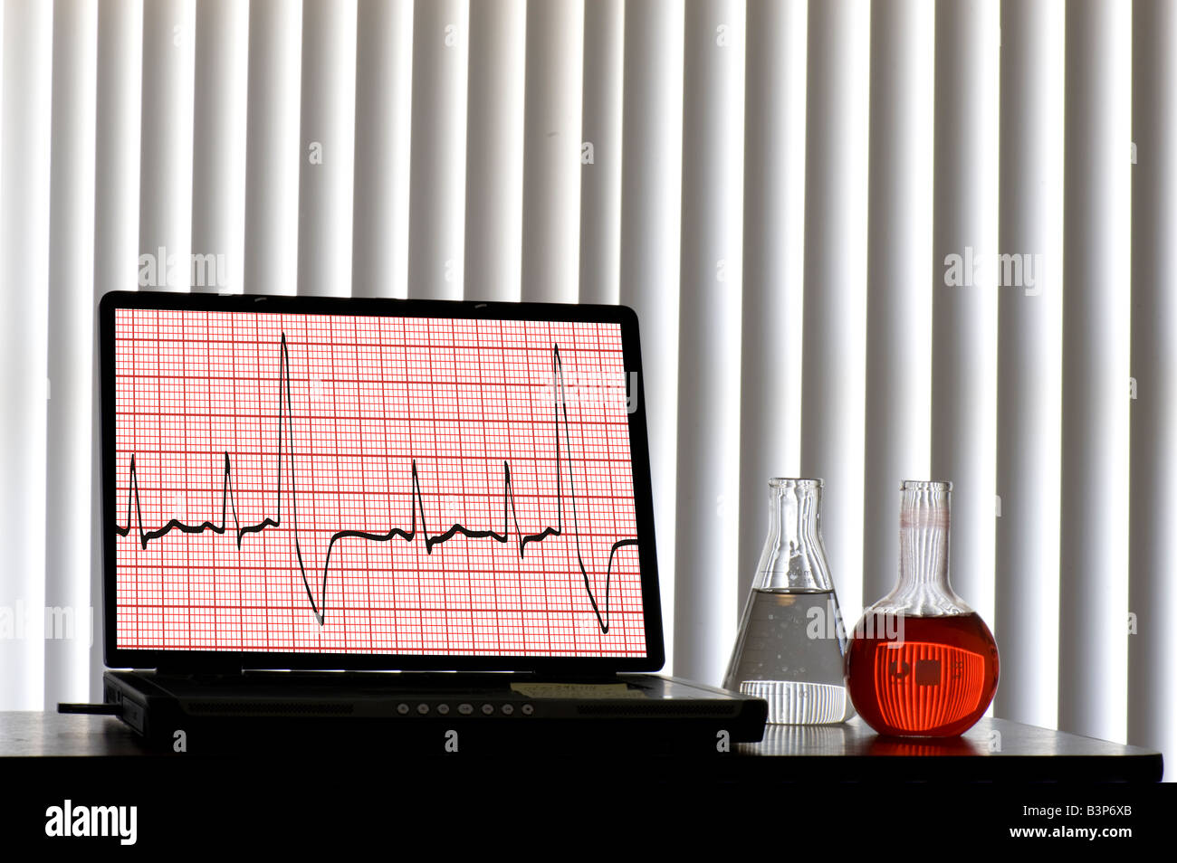 Électrocardiogramme ECG affiché sur un ordinateur portable Banque D'Images